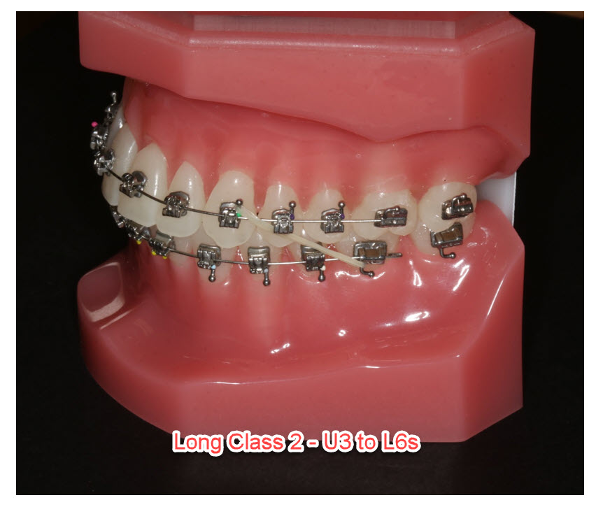 Long class 2