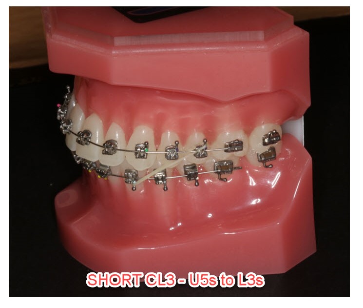 Short CL3s 5to3